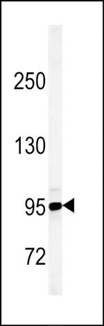 JHDM1D Antibody in Western Blot (WB)