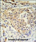 ADFP Antibody in Immunohistochemistry (Paraffin) (IHC (P))