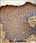 CXCL9 Antibody in Immunohistochemistry (Paraffin) (IHC (P))