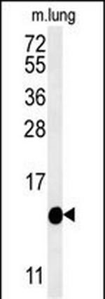 IFT20 Antibody in Western Blot (WB)