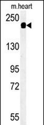 SAMD9L Antibody in Western Blot (WB)