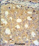 CMPK2 Antibody in Immunohistochemistry (Paraffin) (IHC (P))