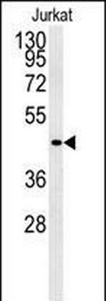 GPR41 Antibody in Western Blot (WB)