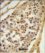 L1TD1 Antibody in Immunohistochemistry (Paraffin) (IHC (P))