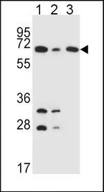 DLAT Antibody in Western Blot (WB)