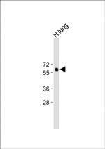 SMAD6 Antibody in Western Blot (WB)