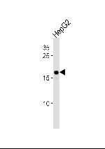 HMGA2 Antibody in Western Blot (WB)