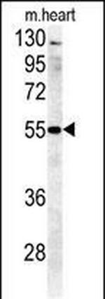 B4GALT5 Antibody in Western Blot (WB)