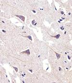 FADS2 Antibody in Immunohistochemistry (Paraffin) (IHC (P))