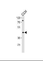 FADS2 Antibody in Western Blot (WB)