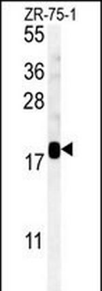 SDHAF1 Antibody in Western Blot (WB)