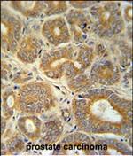 CRABP1 Antibody in Immunohistochemistry (Paraffin) (IHC (P))