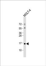 CRABP1 Antibody in Western Blot (WB)