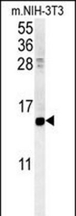 CRABP1 Antibody in Western Blot (WB)