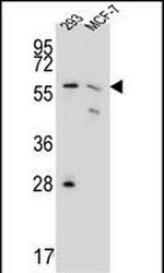 PGD Antibody in Western Blot (WB)