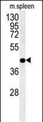 PGD Antibody in Western Blot (WB)