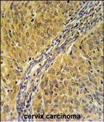 DYNC1LI2 Antibody in Immunohistochemistry (Paraffin) (IHC (P))