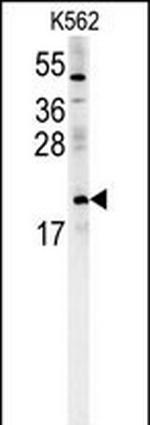 PMCH Antibody in Western Blot (WB)