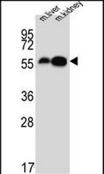 DOPA Decarboxylase Antibody in Western Blot (WB)