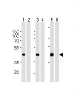 STEAP2 Antibody in Western Blot (WB)