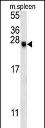 EID2 Antibody in Western Blot (WB)