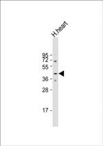 MURC Antibody in Western Blot (WB)