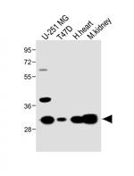 MARCH5 Antibody in Western Blot (WB)