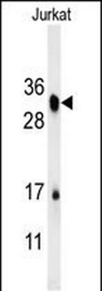 RSPO4 Antibody in Western Blot (WB)