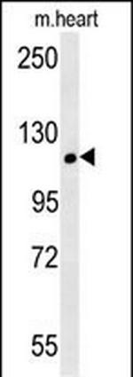 CRB2 Antibody in Western Blot (WB)