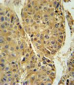 beta-3 Tubulin Antibody in Immunohistochemistry (Paraffin) (IHC (P))