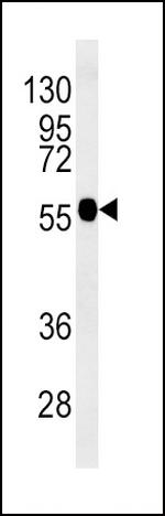 beta-3 Tubulin Antibody in Western Blot (WB)