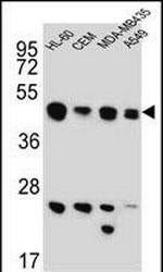 BIN2 Antibody in Western Blot (WB)