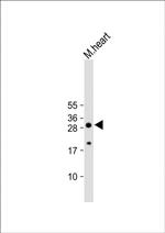 Aquaporin 11 Antibody in Western Blot (WB)