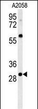 GSTO2 Antibody in Western Blot (WB)