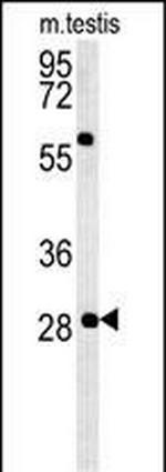 GSTO2 Antibody in Western Blot (WB)