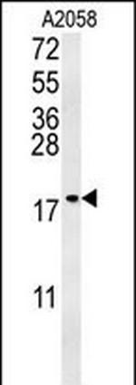 GM2A Antibody in Western Blot (WB)