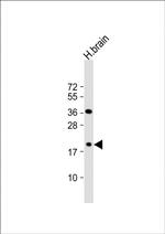 beta Synuclein Antibody in Western Blot (WB)