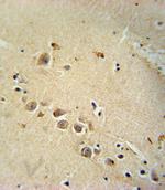 RASGRP1 Antibody in Immunohistochemistry (Paraffin) (IHC (P))