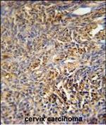 TANK Antibody in Immunohistochemistry (Paraffin) (IHC (P))