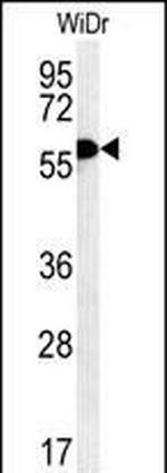 TANK Antibody in Western Blot (WB)