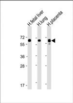 PPAR gamma Antibody in Western Blot (WB)