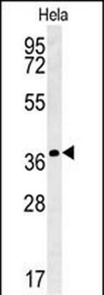 IL24 Antibody in Western Blot (WB)