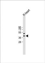 HEY2 Antibody in Western Blot (WB)