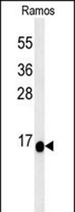 C1orf186 Antibody in Western Blot (WB)