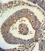 Calreticulin Antibody in Immunohistochemistry (Paraffin) (IHC (P))