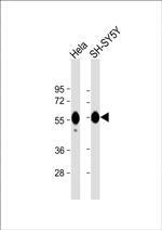 Calreticulin Antibody in Western Blot (WB)