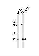 Carbonic Anhydrase II Antibody in Western Blot (WB)