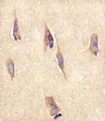 NPTX1 Antibody in Immunohistochemistry (Paraffin) (IHC (P))