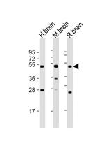 NPTX1 Antibody in Western Blot (WB)