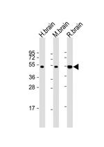 NPTX1 Antibody in Western Blot (WB)